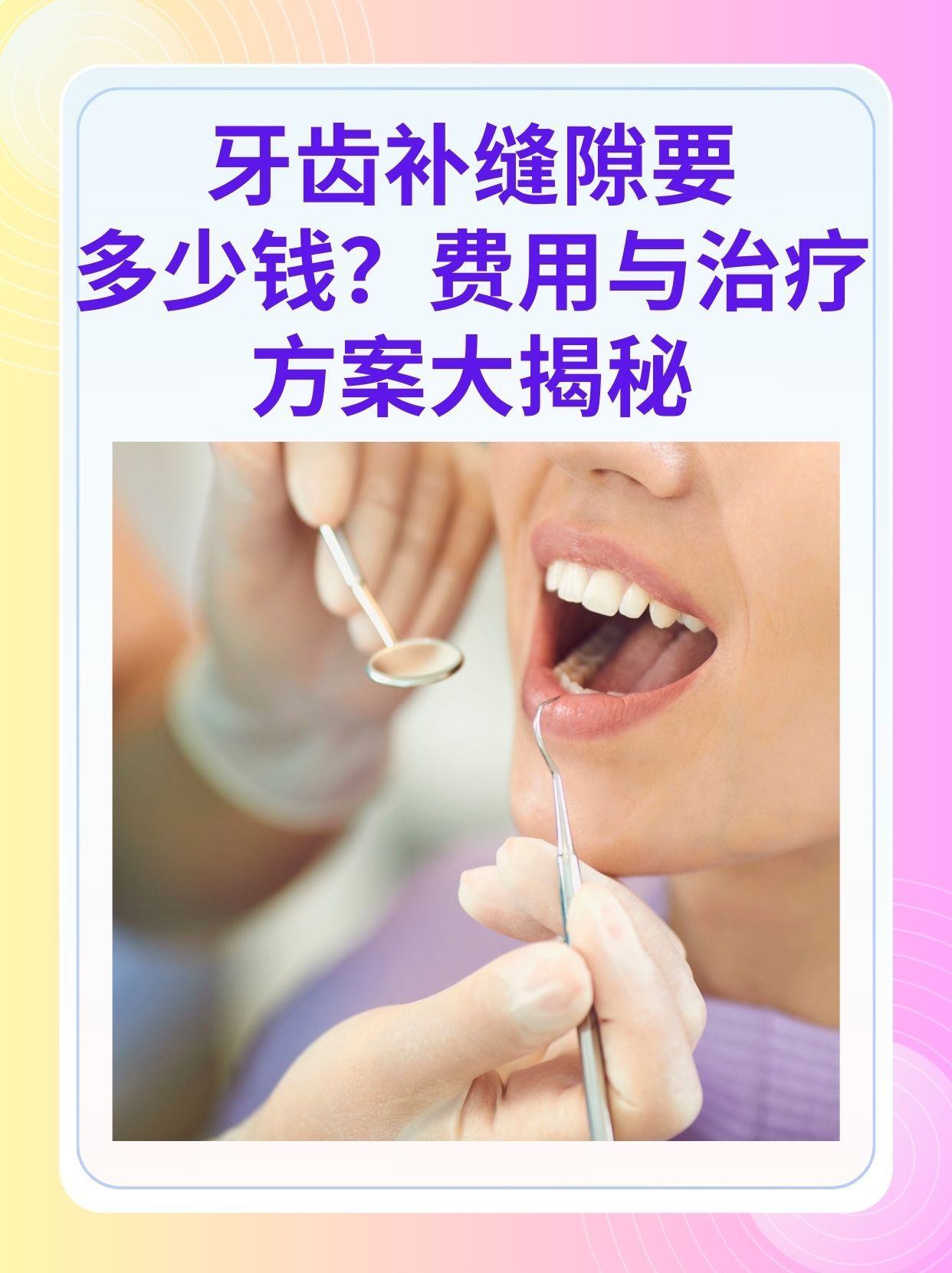 三门峡补牙医保可以报销吗(补牙医保可以报销吗 哪些可以报销呢)